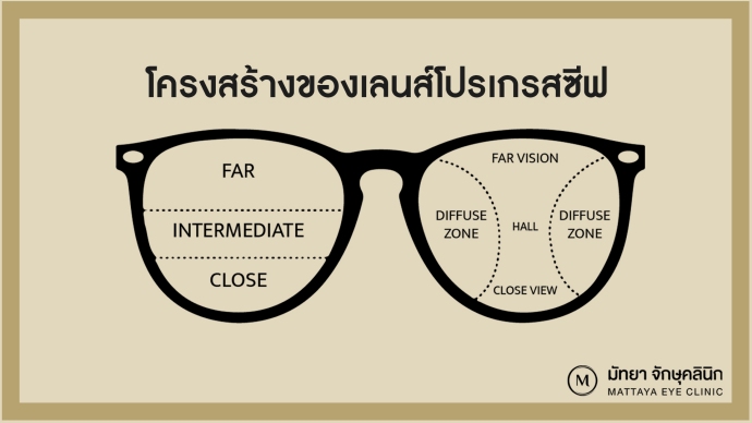 เลนส์โปรเกรสซีฟ