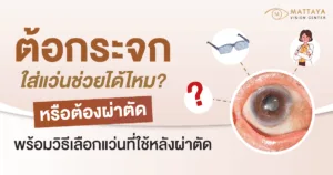 ต้อกระจก ใส่แว่นช่วยได้ไหม