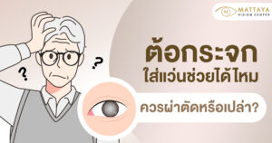 ต้อกระจก