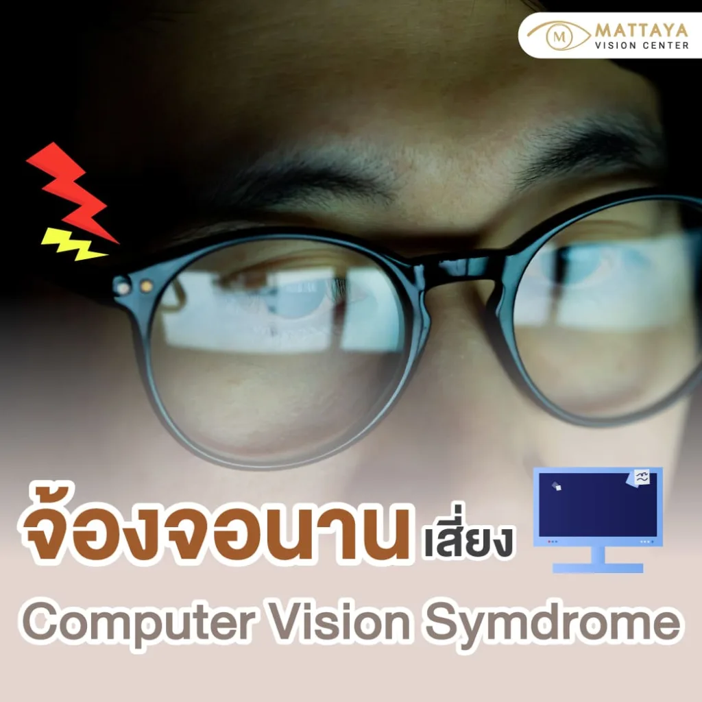 ภัยเงียบยุคดิจิทัล ทำความรู้จัก Computer Vision Syndrome (CVS)