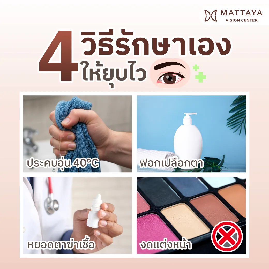 4 วิธีรักษาตากุ้งยิง เร่งด่วน ด้วยตัวเอง